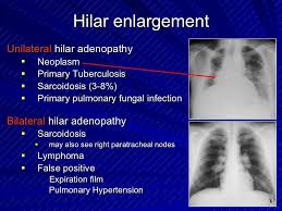 Pin On Thorax