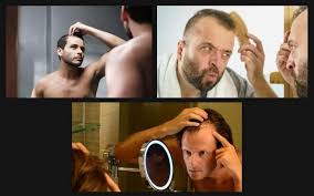 Since numerous autosomal genes are related to baldness, they can form pairs in many different combinations, meaning there is an unknown chance that your father's baldness genes are effectuated. How To Tell If You Re Going Bald The Bald Company