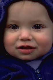 Language Outcomes in Young Children with A Hearing Loss