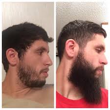 However, unfortunately, your facial hair does not always play the game. What 10 Months Of Growth Does To Patches Beards