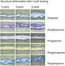 Image result for Suture Material