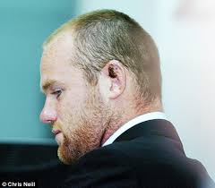 Which is rs 1365 crores in indian rupees. Wayne Rooney S Nasty Ear Injury Is Revealed For The First Time As He Flies Off To Malaysia Daily Mail Online