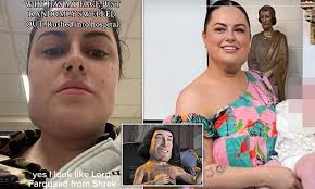 I paid £5,000 for liposuction to tackle my double chin