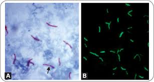 Mycobacteria | Basicmedical Key