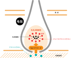 Aga 男性型脱毛症 とは 公式 薄毛 Aga治療の主治医をお探しならdクリニックへ