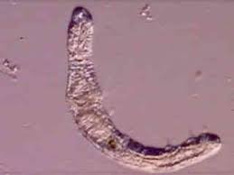 Nostoc and anabaena are common cyanobacteria that are found in pond water. Pond Life Video Gallery Nikon S Microscopyu