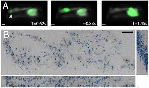Maybe you would like to learn more about one of these? A Versatile Oblique Plane Microscope For Large Scale And High Resolution Imaging Of Subcellular Dynamics Elife