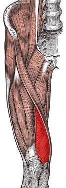 Patellofemoral Pain Syndrome Wikipedia