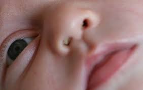 Cuidados Del Recien Nacido Como Limpiar La Nariz Del Bebe Cuidados Del Recien Nacido Cuidados De Bebes Bebes Recien Nacidos Cuidados