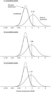 Relative Frequency Distributions Of Nuchal Translucency Open I