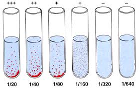 Widal Test Introduction Principle Procedure