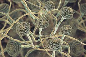 Vzhled kolonií je při určování nutné doplnit mikroskopickým pozorováním struktury hyf a konidií. Illustration Of Fruiting Bodies And Hyphae Of Fungus Aspergillus Fumigatus Microbiological Microbiology Stock Photo 212348176
