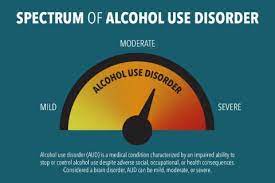 Understanding Alcohol Use Disorder | National Institute On Alcohol Abuse  And Alcoholism (Niaaa)