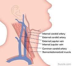 תוצאת תמונה עבור Internal Carotid Artery Carotid Artery Diagnostic Medical Sonography Sternocleidomastoid Muscle