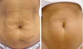 Mar 19, 2021 · exercises that focus on the midsection won't lead you to magically wake up with less belly fat. Pin On I I I Workouuuuut