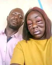 Le VIH/Sida m'a transformé en autre chose au bout de quelques  années😭😭😭😭 je m'appelle *Marie wasam* depuis l'Allemagne .J'ai toujours  maintenu ma forme initiale au début. Seulement un petit matin la maladie