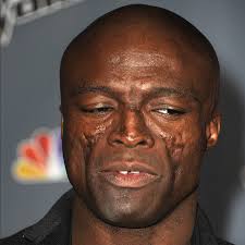 Wanna know how he got those scars?