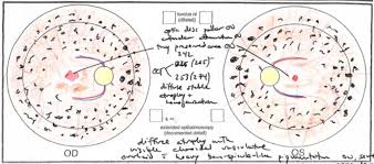 Retinal Drawing At Getdrawings Com Free For Personal Use