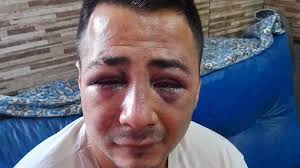 Allanaron El Boliche Donde Un Hombre Denuncio Ser Golpeado El Diario De Pilar