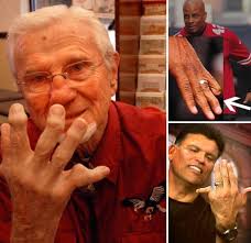 Jack Concannon, former NFL quarterback