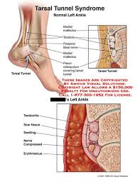 Pin On Medicine