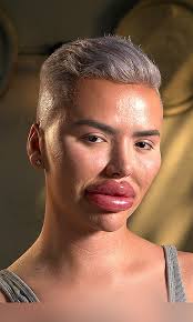 My Date Has Spent $300K On Surgery