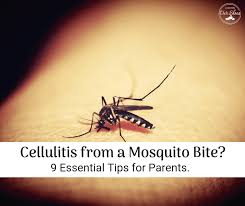 A mosquito bite is a small, round, puffy bump that appears soon after you've been bitten. Cellulitis From A Bug Bite Yes And Here S What To Look For A Day In Our Shoes