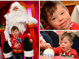 The incredible four-year-old who has major surgery every six weeks