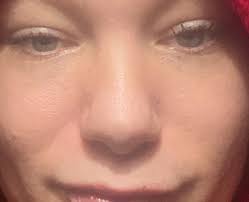 First month vs 8 months why it looks so bigger now and tip so lower