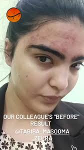 Tabiba Masooma Zehra — the epitome of passion and strength* With gentle  hands and a heart full of compassion, she checks the pulse of our adorable  little patient at *Matab-e-Inqalab*. 💝 Her