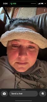 Rose. She had a bad infection in her right eye. Very bad. Couldn't catch  her. So, Nancy made sure she got supplements in her food. Mixed with  prayer, her URI and eye