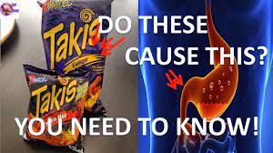 Do Takis Really Cause Gastritis Youtube