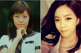 13 Korean Celebrities Who Have Admitted To Plastic Surgery Plastic Surgery Celebrity Plastic Surgery Korean Celebrities