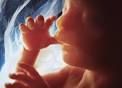Foetus sa