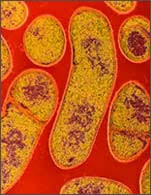 Under certain conditions, these organisms may grow in foods. Clostridium Botulinum One Nasty Bug The Cause Of Botulism Marler Blog