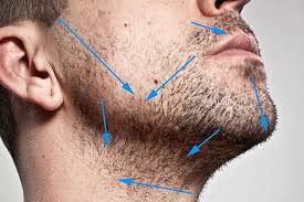 Although these ingrown hair go away in time but there are several homemade treatments that can help you release the uneasy feeling of ingrown hair quickly. The Best Electric Shaver For Ingrown Hairs Online Health Tips