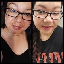 Please help!!! I am losing my confident with this hyperpigmentation under  my lips… its been morethan a year and I don't know what i can use to remove  this. Thanks