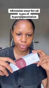 This toner helps manage pdl, melasma, fades spots, resolves  hyperpigmentation and brightens the skin. It’s worth every penny., Key  ingredient : 5% tranexamic acid, green tea extract (camella sensis), ...