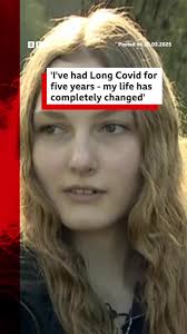 Long Covid: Misdiagnosis and NHS Support Explained