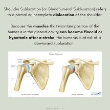 Image result for Shoulder Subluxation