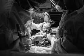 21 Incredibly Moving Photos That Capture The Beauty Of C Section Births Child Birth Photography Birth Pictures Birth Photography Hospital