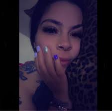 Allergic to chicken dandruff causing hives