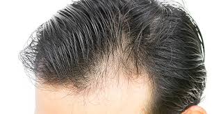 Hair grows at the rate of 1/2 inch per month. Should You Sleep With Pomade In Your Hair