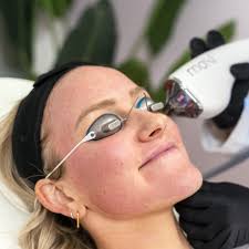 Experience Luxury Aesthetics in Tampa