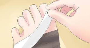 Nani mengungkapkan, itu salah satu penyebab sel kanker menyebar cepat di kaki kanannya. Cara Merawat Lutut Terkilir 13 Langkah Dengan Gambar Wikihow