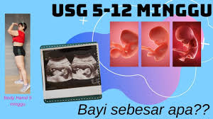 Perkembangan Janin Usia 5 12 Minggu Sudah Sebesar Apa Usg 5 12 W Pre Di 2020 Minggu Youtube Hamil