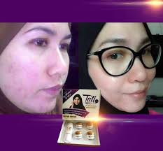 Sr12 (skin relieve 12) merupakan merk produk herbal skincare. Tati Skincare Set Lengkap Original Murah Berkesan Tiptop Beauty Shop Murah