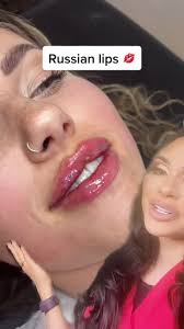 Transform your lips with the Russian lip technique I explain how in this  short video #beforeandafter #foryourpage #foryou #russianlip #russianlips