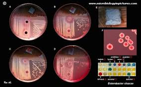 Image result for Enterobacter