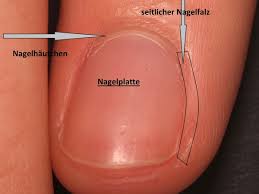 Image result for paronychium